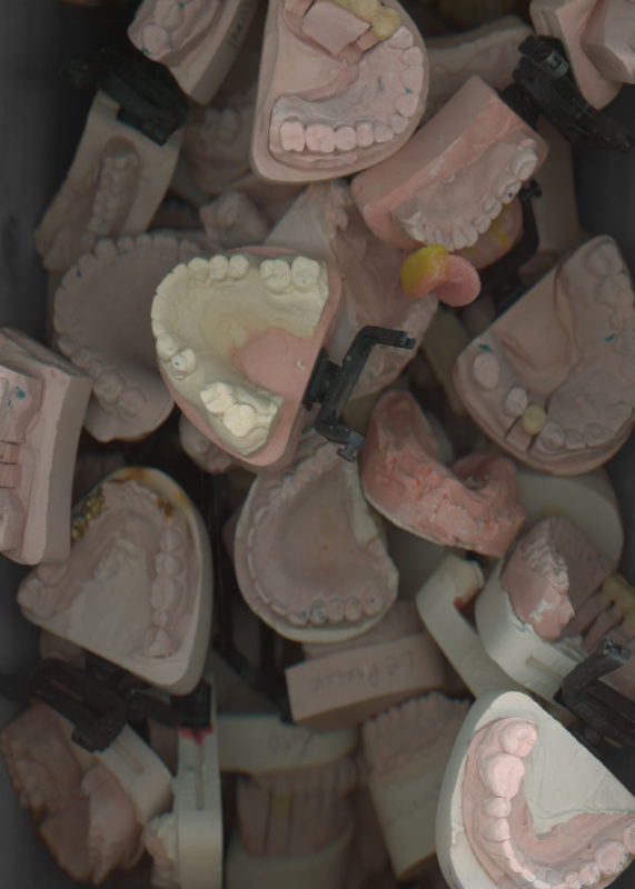 HUMAN TEETH MOULDS, HÔPITAL SAINT-ANTOINE, PARIS, 2020 KATERINA JEBB